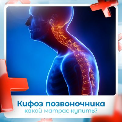 Какой матрас при кифозе