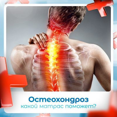 Какой матрас при остеохондрозе