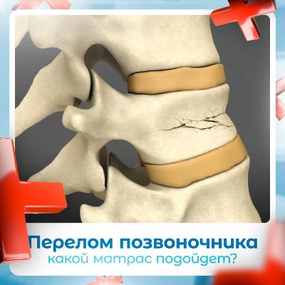 Какой матрас при переломе позвоночника